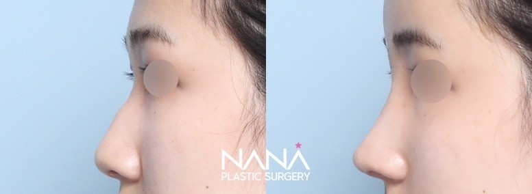 Before & After Before & After