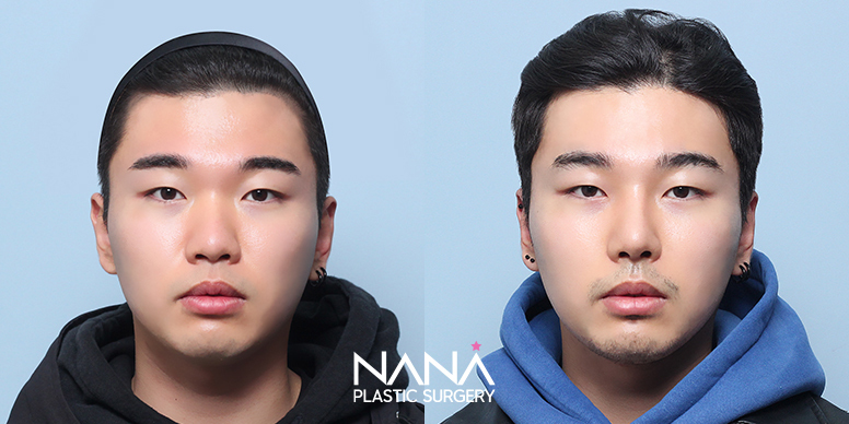 Before & After Before & After