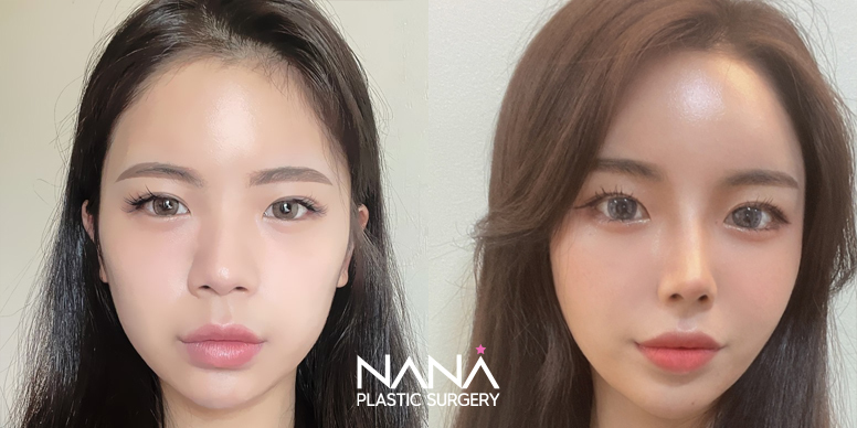 Before & After Before & After