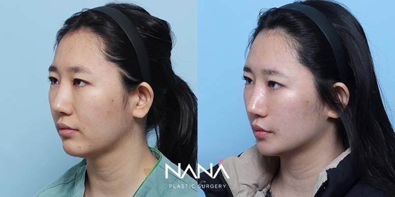 Before & After Before & After