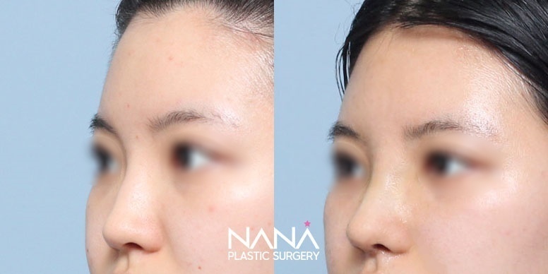 Before & After Before & After