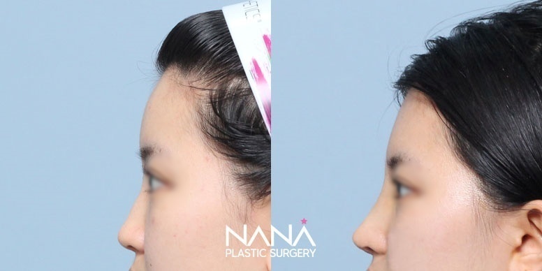 Before & After Before & After