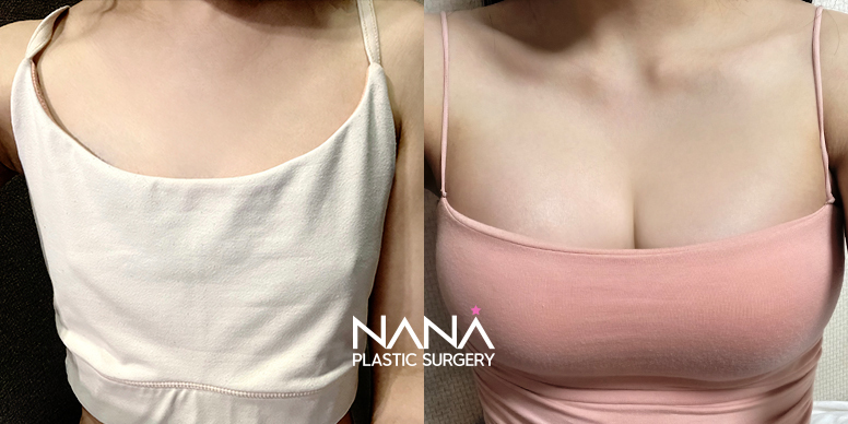 Before & After Before & After