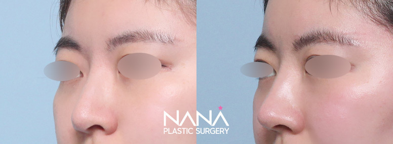Before & After Before & After