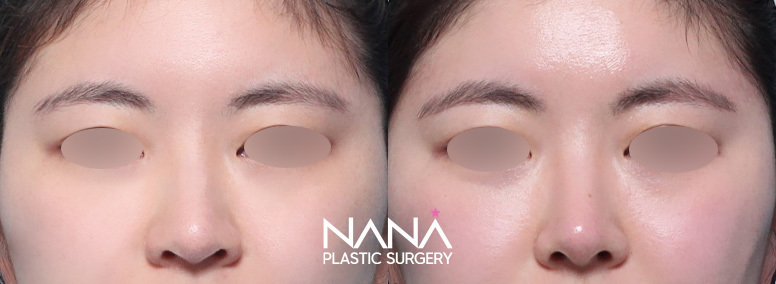 Before & After Before & After