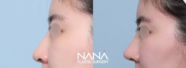 Before & After Before & After