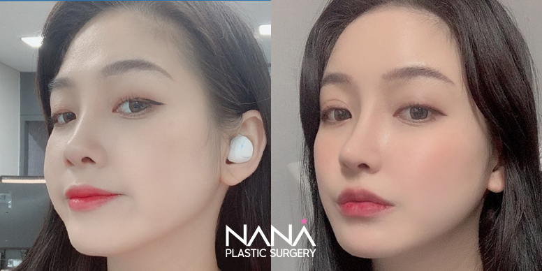 Before & After Before & After