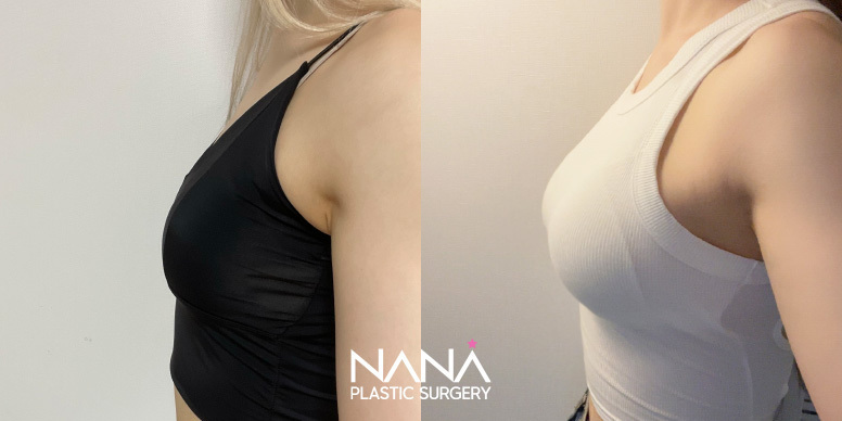 Before & After Before & After