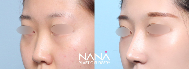 Before & After Before & After