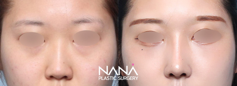 Before & After Before & After