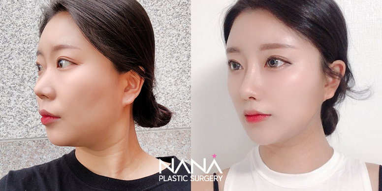 Before & After Before & After
