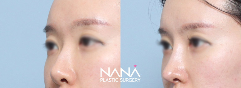 Before & After Before & After
