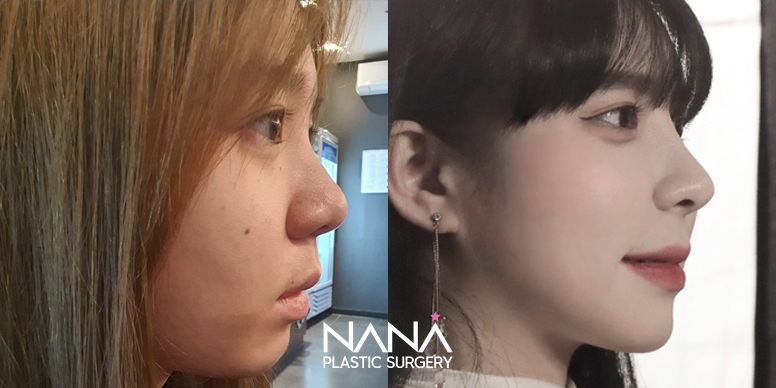 Before & After Before & After