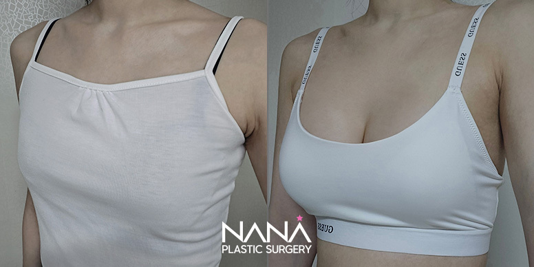Before & After Before & After