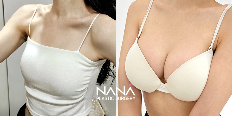 Before & After Before & After