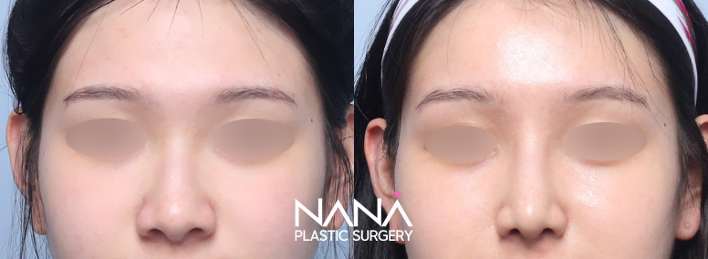Before & After Before & After