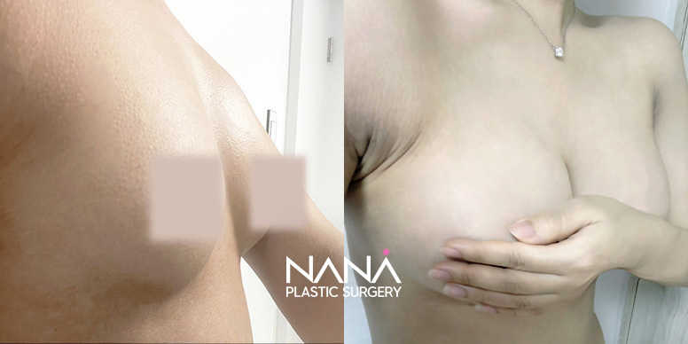 Before & After Before & After