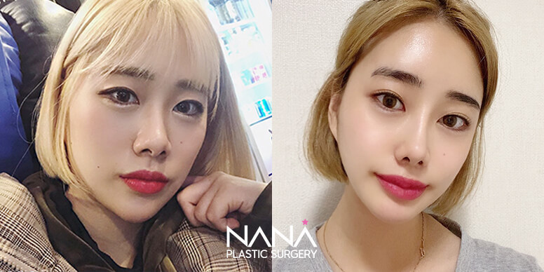 Before & After Before & After