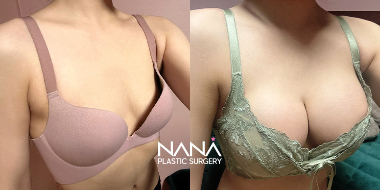 Before & After Before & After
