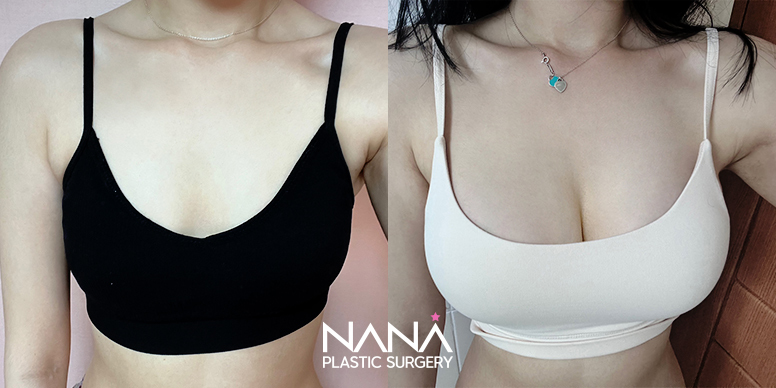 Before & After Before & After