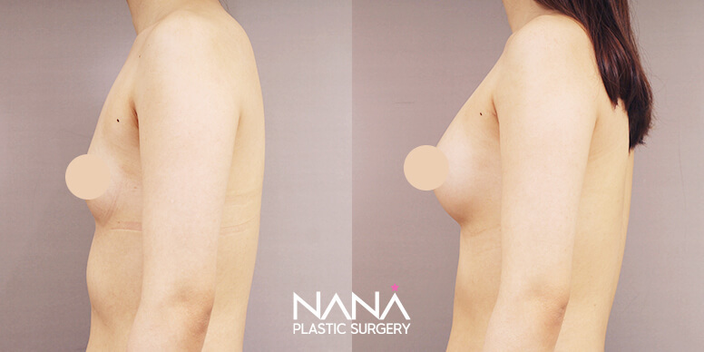 Before & After Before & After