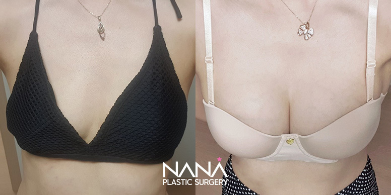 Before & After Before & After