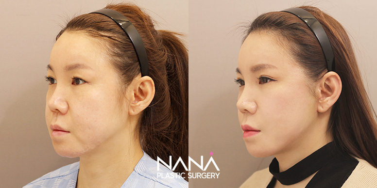 Before & After Before & After