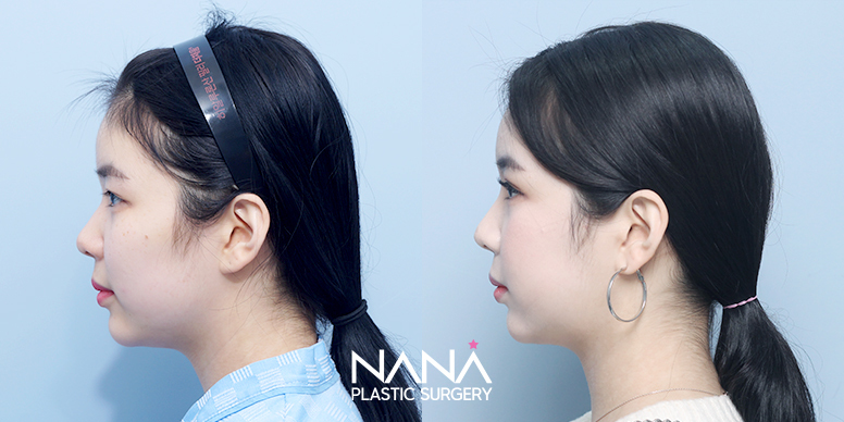 Before & After Before & After