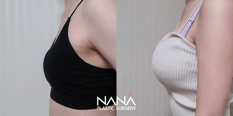 Before & After Before & After