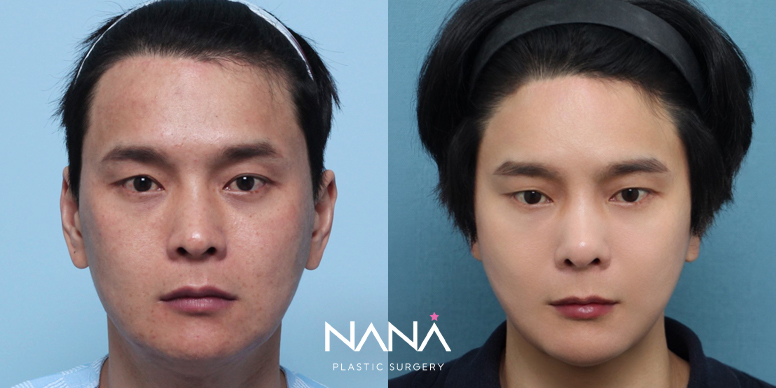 Before & After Before & After