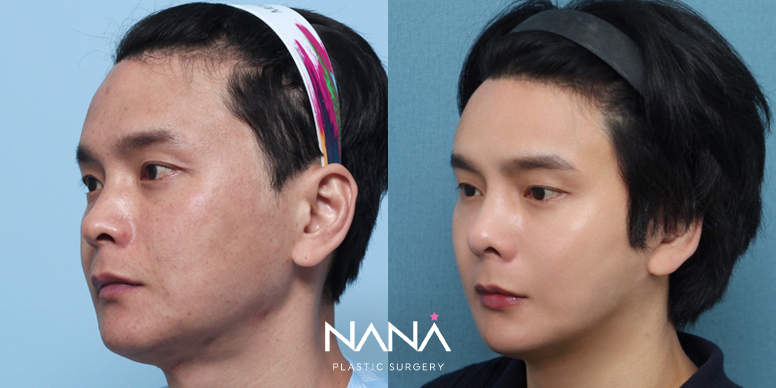Before & After Before & After