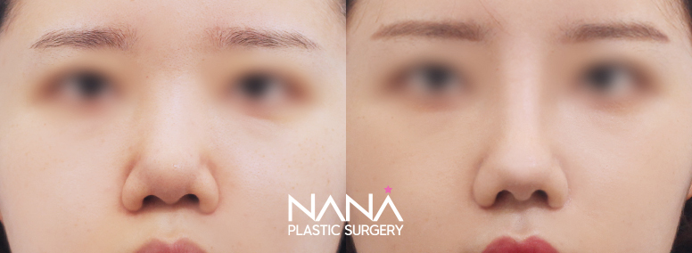 Before & After Before & After