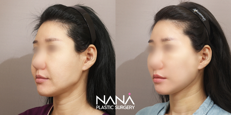Before & After Before & After