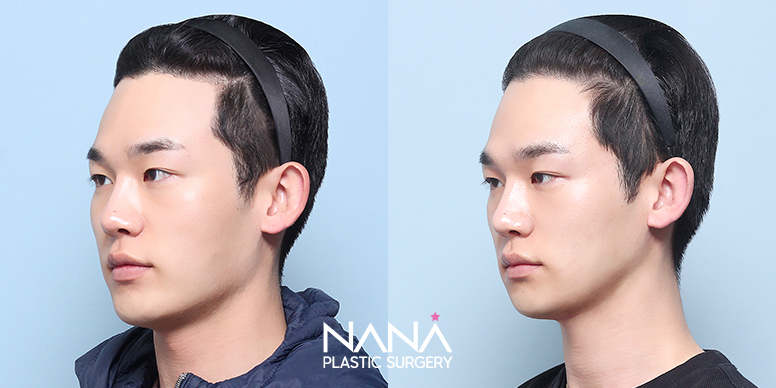 Before & After Before & After