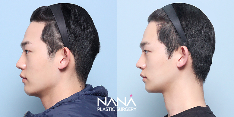 Before & After Before & After