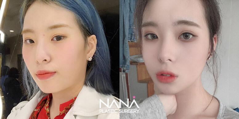 Before & After Before & After