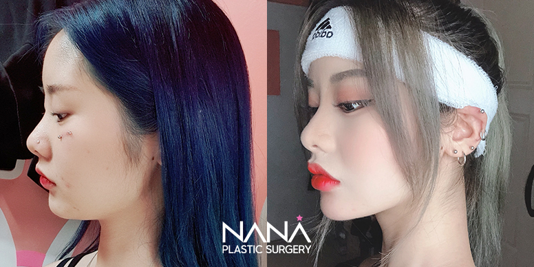 Before & After Before & After