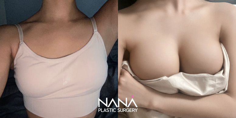 Before & After Before & After