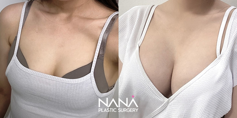 Before & After Before & After