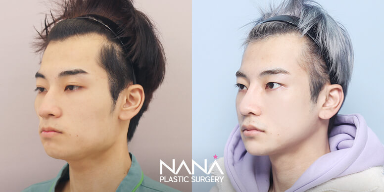Before & After Before & After