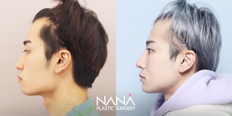 Before & After Before & After