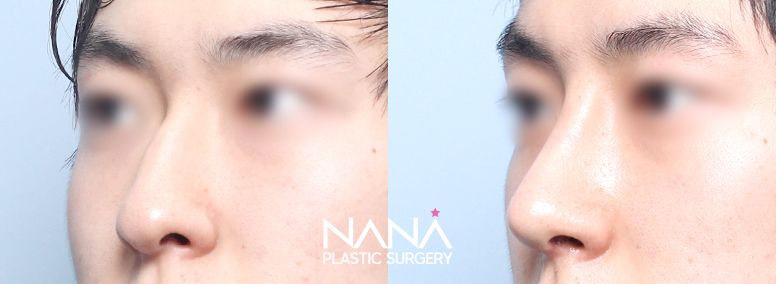 Before & After Before & After