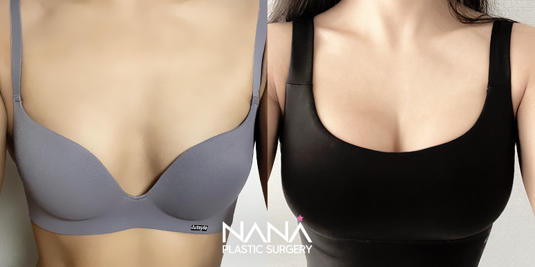 Breast Before & After — Before & After
