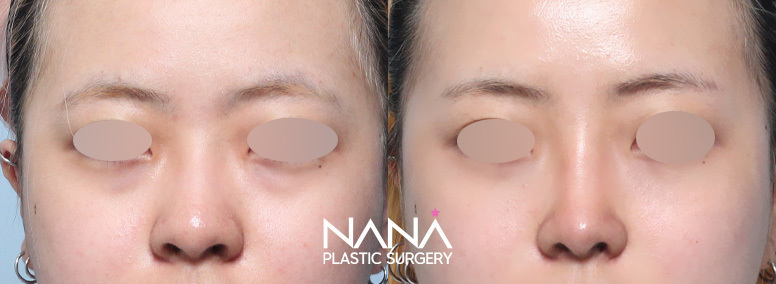 Before & After Before & After