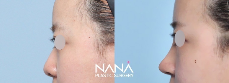 Before & After Before & After