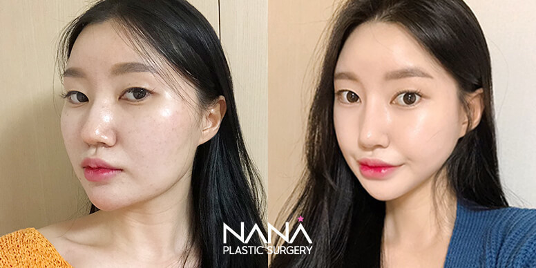 Before & After Before & After