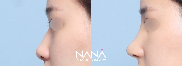 Before & After Before & After