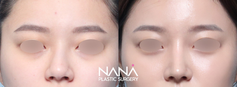 Before & After Before & After