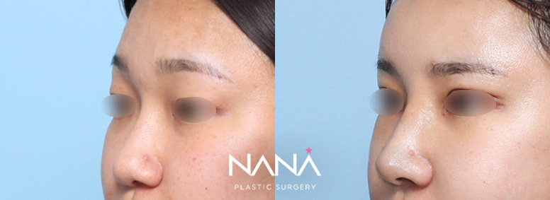 Before & After Before & After