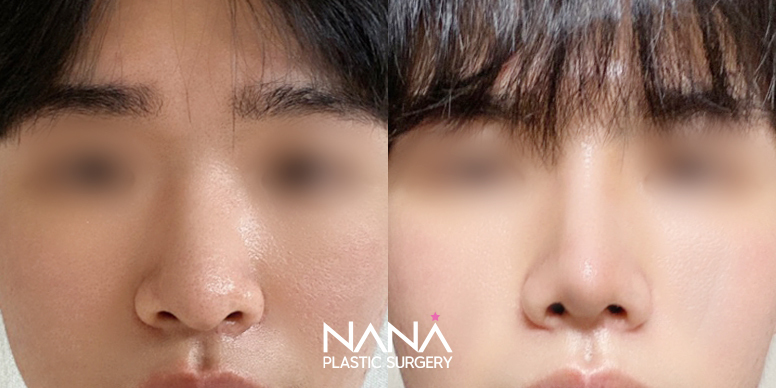 Before & After Before & After